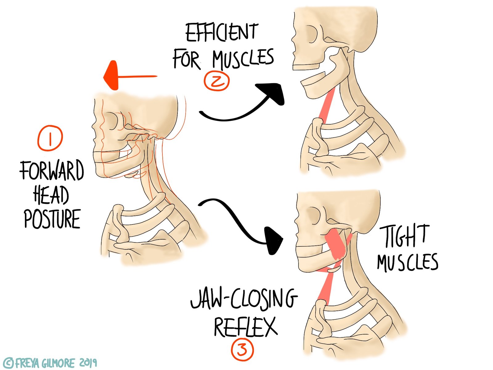 The TMJ jaw pain and clicking Gemini Osteopathy