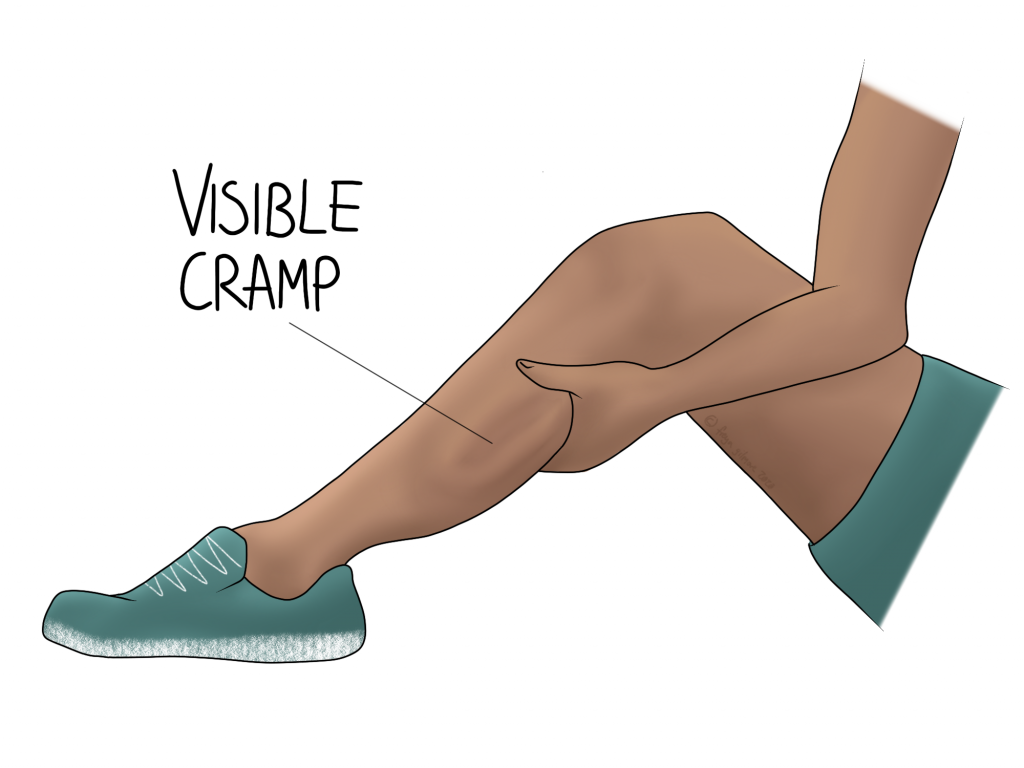 What To Do If You Get A Cramp While Running at Bill Kohlmeier blog