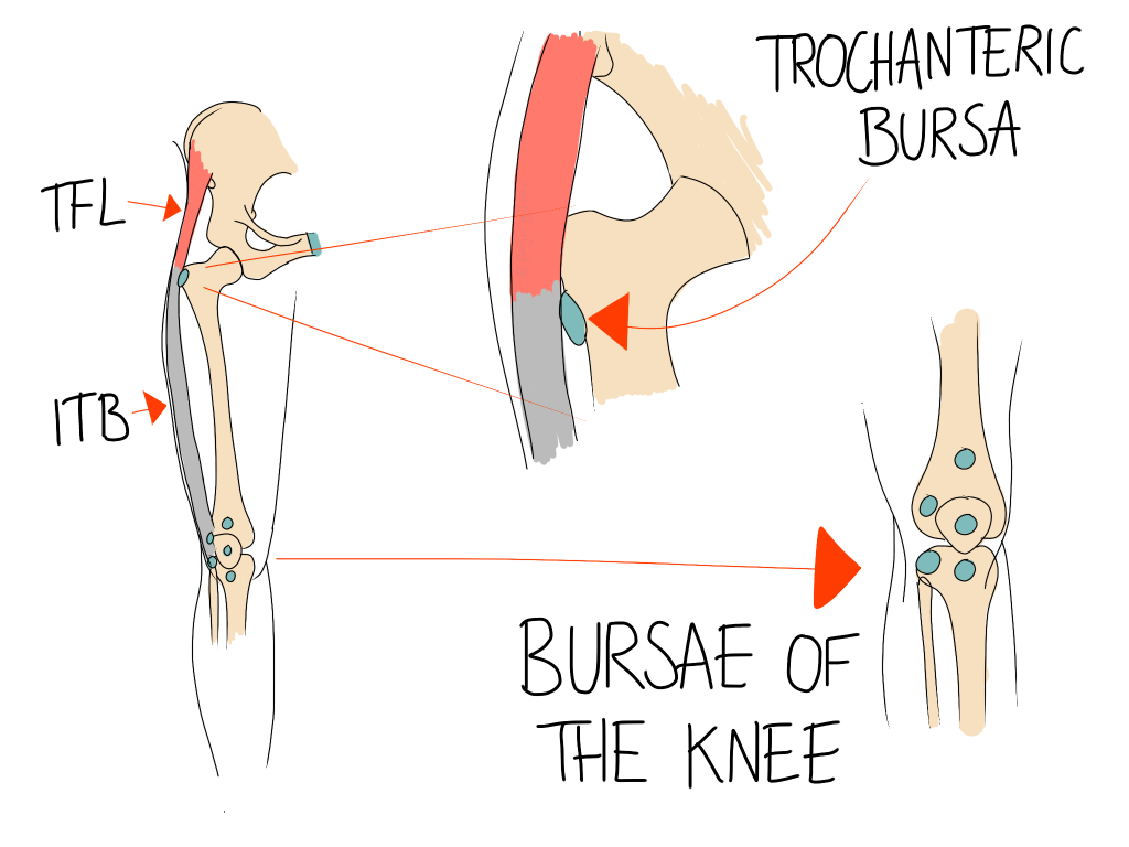 Bursitis 