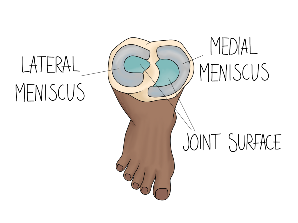 Meniscus Tears