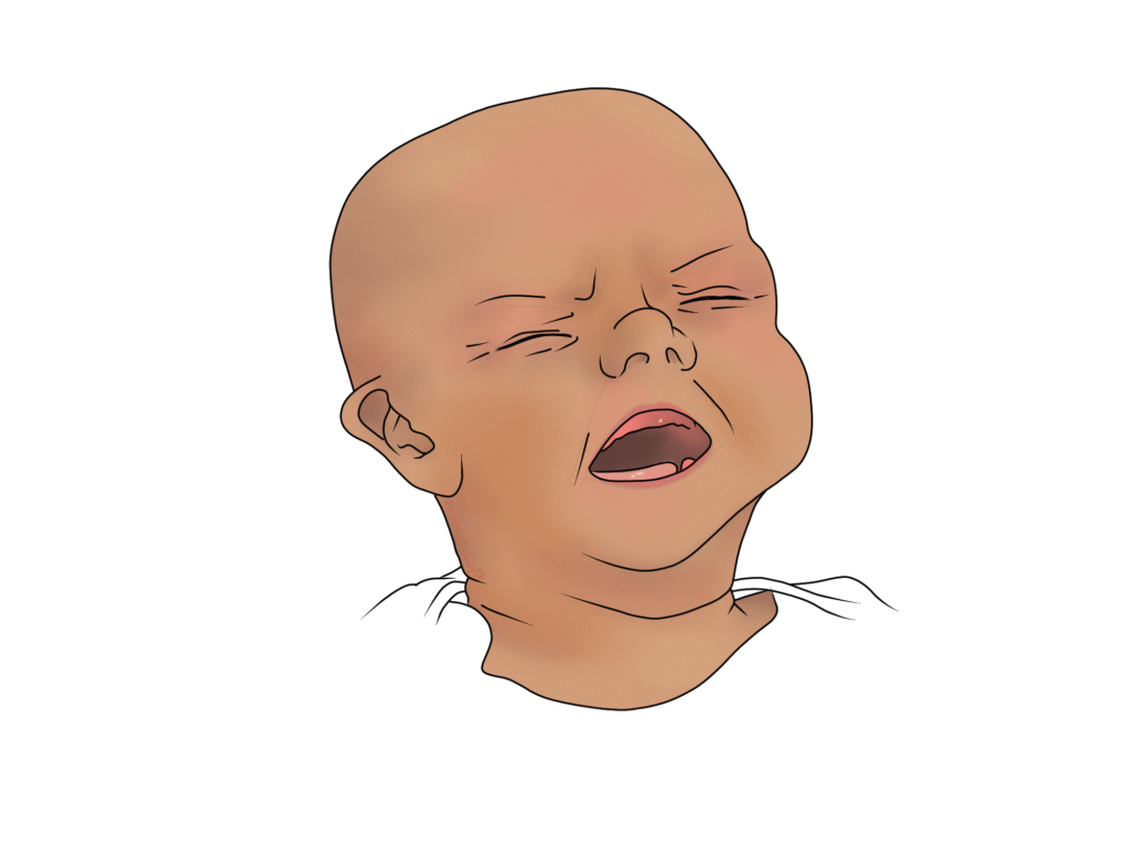 Colic and crying